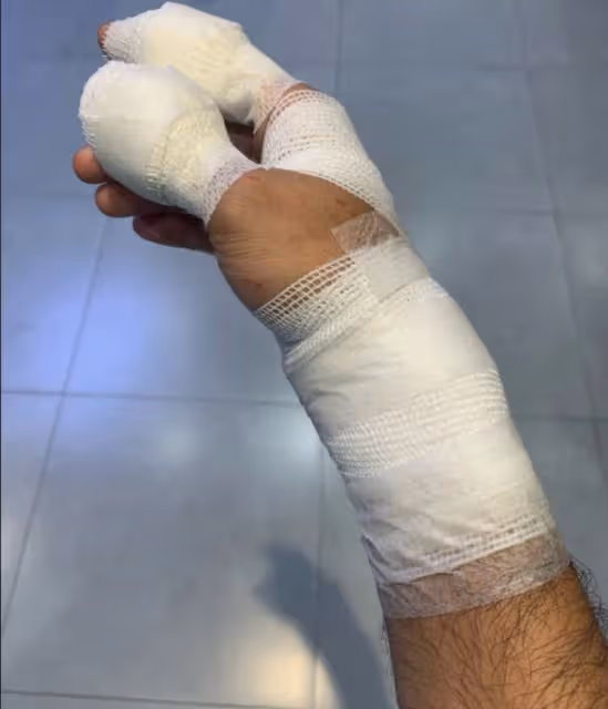 39歲唐宸禹意外受傷,手上纏滿紗布惹人憂,曾被抑鬱症困擾多年