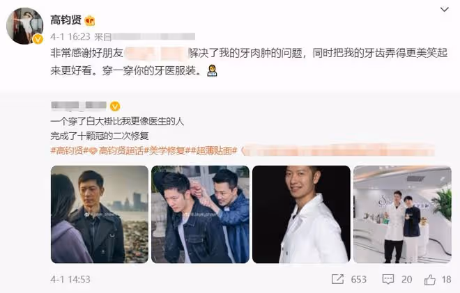 TVB男星高鈞賢回內地發展,入行17年首演男一號,開機前整10顆牙