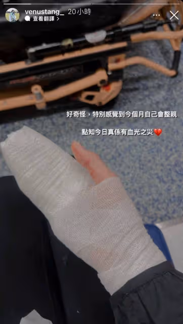 28歲港星被狗咬傷!做4次手術住院2周才出院,還因此喪失拍劇機會