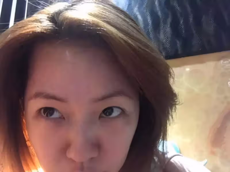 變僵臉怪了!小S自爆「進廠維修修過頭」超後悔 PO出成果「媽媽也嚇壞開罵」:破壞老娘的作品