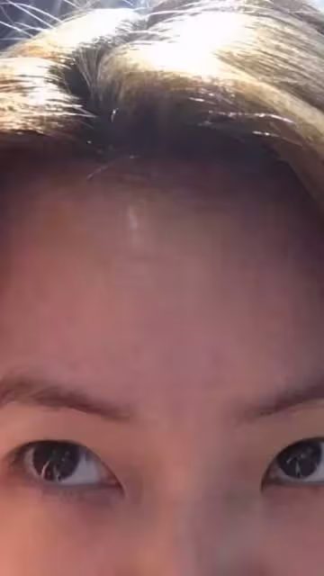 變僵臉怪了!小S自爆「進廠維修修過頭」超後悔 PO出成果「媽媽也嚇壞開罵」:破壞老娘的作品