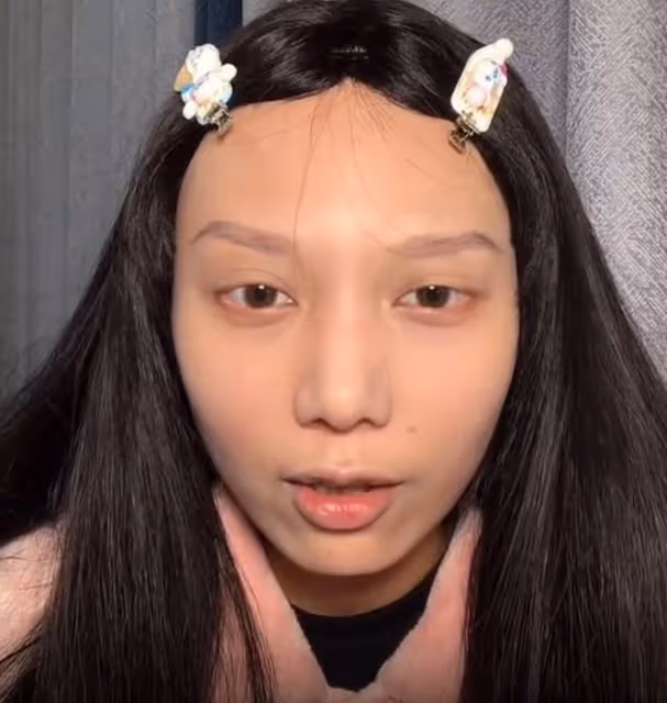 又一網紅患癌！22歲小羊剃光頭化療6次，已做切除手術將終身不孕