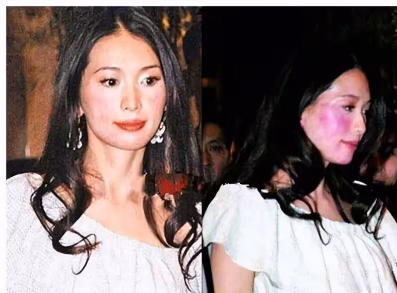 4位明星的隱疾!小嫻天生沒子宮「無法生育」被夫家嫌棄離婚 功夫巨星罹患:忽胖忽瘦「還影響心臟」