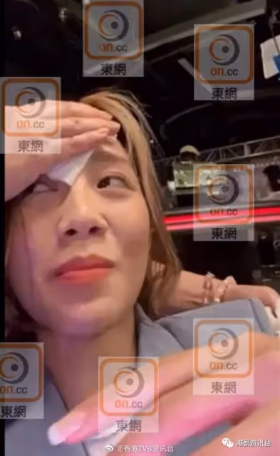 方力申玩出禍！TVB港姐被他突襲受傷被縫16針