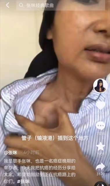 張咪抗癌日再談自身經歷,3年前確診癌症晚期,曾為自己設計葬禮