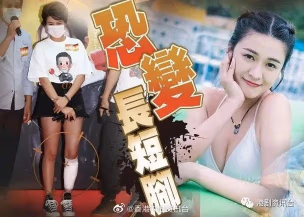 TVB小花撰分手文暗寸前度!美腿突然重創傷上加傷