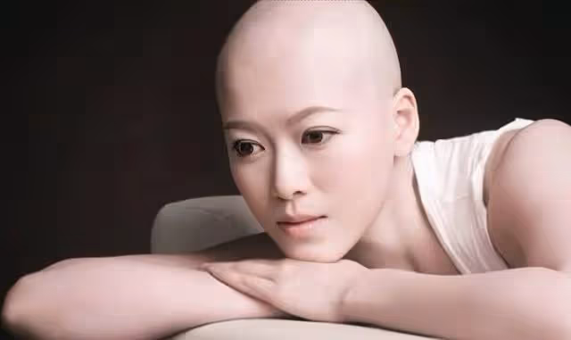 擔心!TVB知名女星乳癌康復後留下後遺症,偶爾會出現腦霧、斷片