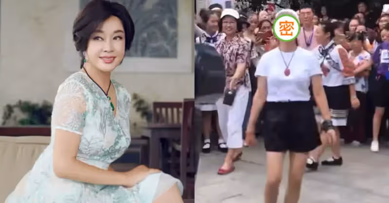 69歲劉曉慶，穿短褲裝年輕，臉頰飽滿顯怪異，網友：沒有普通老人看起來舒服