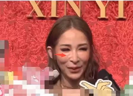 41歲蕭亞軒近照曝光,臉色紅潤不再似「巫婆」,網友:就愛你原來的樣子