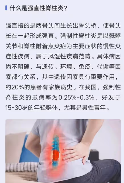 周杰倫被曝呼吸不暢，早前一直受強直性脊柱炎困擾，昆凌：沒事了