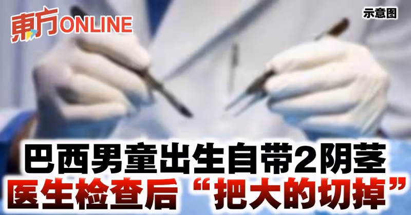 巴西男童出生自帶2陰莖　醫生檢查後「把大的切掉」