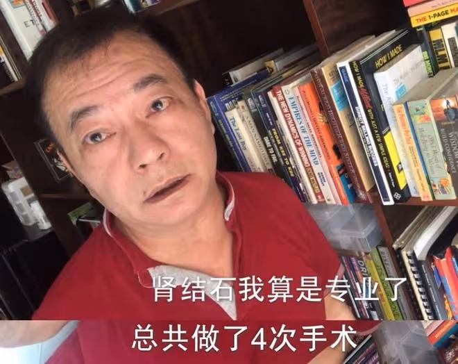 竟被割錯盲腸！　阿燦廖偉雄痛揭經歷4次腎結石手術