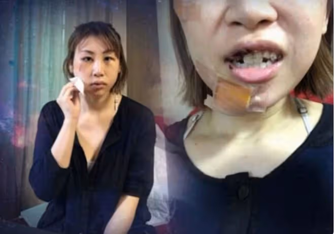 大家應該都知道,娛樂圈的明星大多數都整過容,朴詩妍也不例外