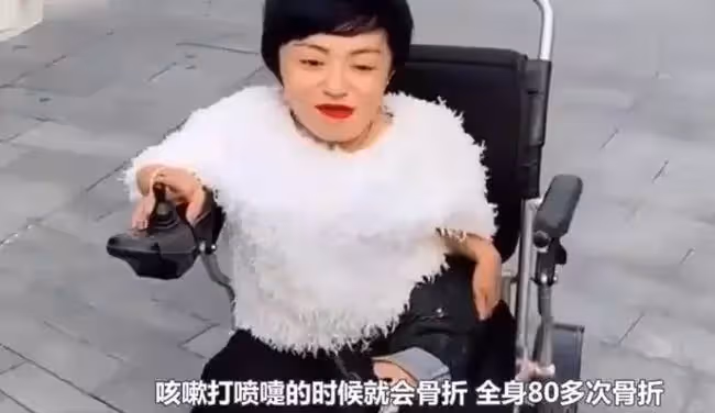 身高僅80公分,不顧父母反對嫁180公分老公,沒錢後被拋棄獨自帶兒打拚創業,擁千萬身家