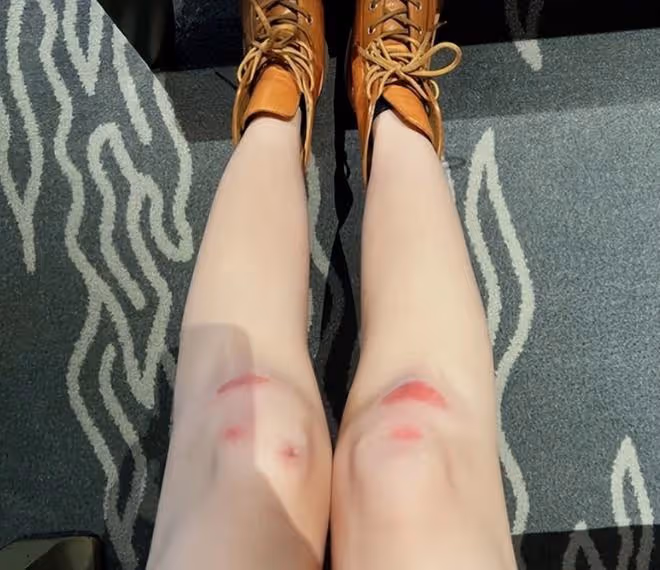 林志穎妻子開豪車出行,穿戴一身奢華品買冰淇淋,膝蓋受傷明顯