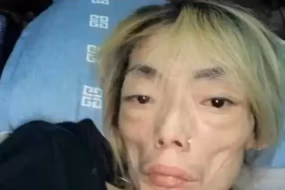 她22歲如花似玉邁入豪門!8年後卻變得骨瘦如柴 僅因丈夫一句話「瘦到22公斤」