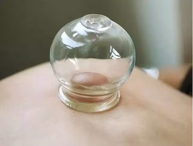 拔火罐吸出來的淤血,是體內的毒素?告訴你真相,看完漲知識了