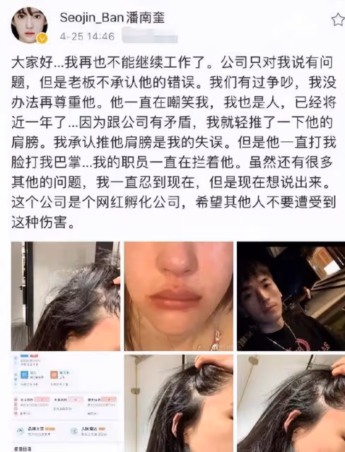 花十億整容成baby，後發展成網紅瘋狂撈金