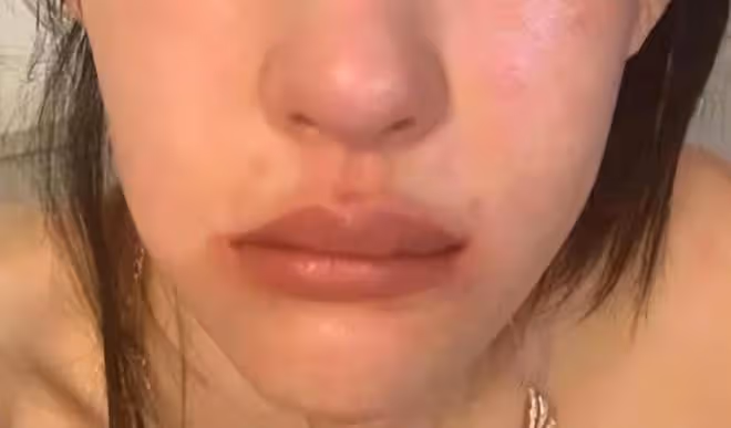 花十億整容成baby，後發展成網紅瘋狂撈金