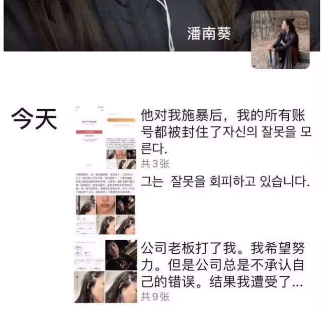 花十億整容成baby，後發展成網紅瘋狂撈金