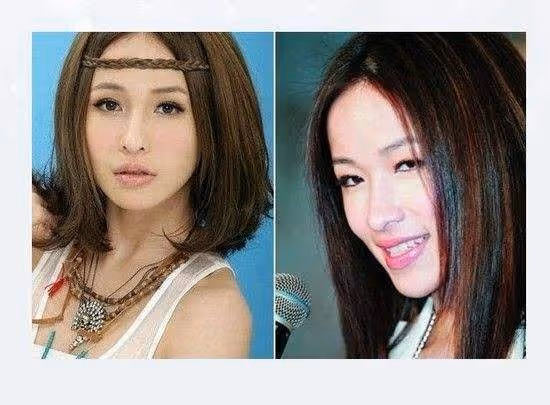內娛最假雙眼皮PK,就差割到腦門了,生怕別人看不出是割的?