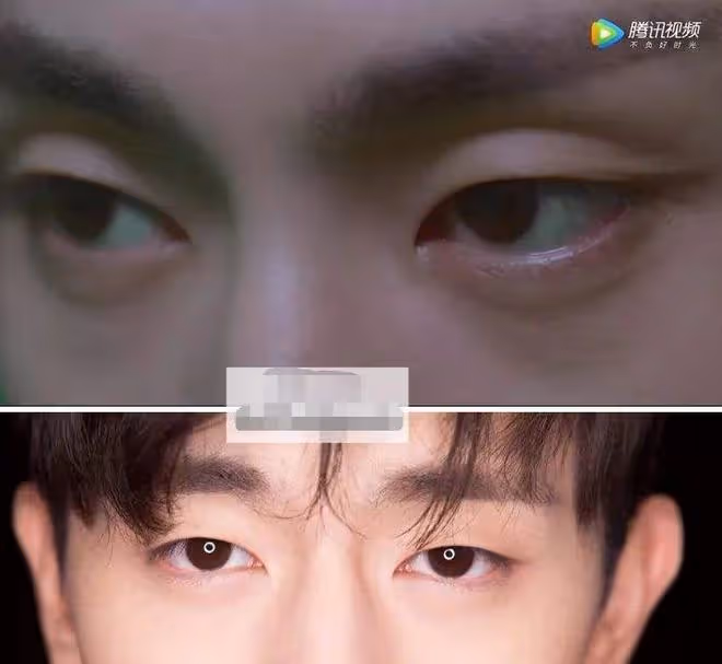 內娛最假雙眼皮PK,就差割到腦門了,生怕別人看不出是割的?
