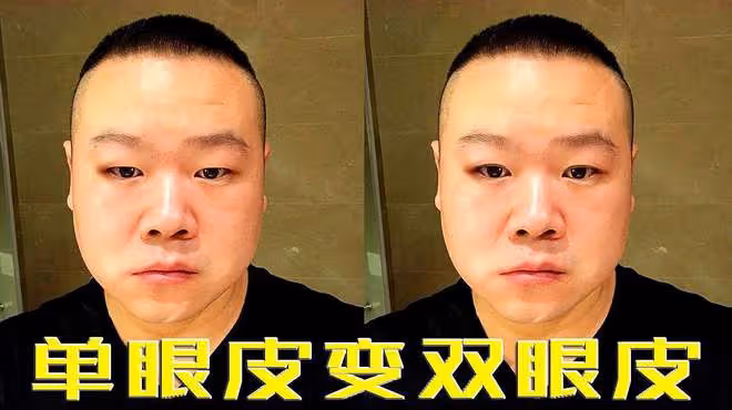 內娛最假雙眼皮PK,就差割到腦門了,生怕別人看不出是割的?