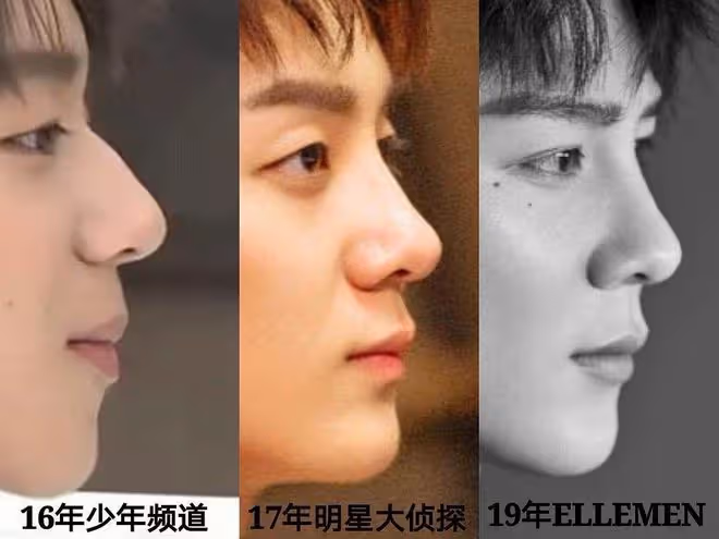 出道了還去整容？換了張臉再出來，自封純天然，他們當觀眾傻嗎？