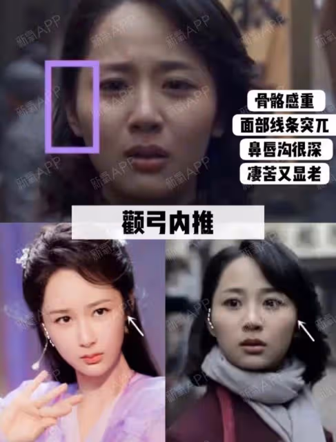 出道了還去整容?換了張臉再出來,自封純天然,他們當觀眾傻嗎?