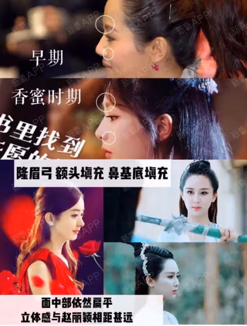 出道了還去整容?換了張臉再出來,自封純天然,他們當觀眾傻嗎?