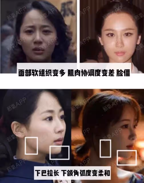 出道了還去整容?換了張臉再出來,自封純天然,他們當觀眾傻嗎?