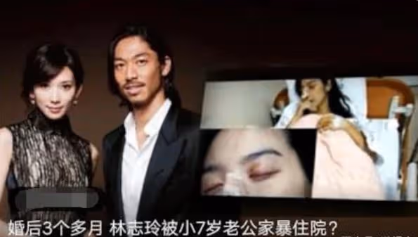 林志玲「被家暴」為何不離婚?外媒報道成笑話,看日本離婚啥代價