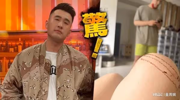 34歲男星確診後,將女友人打進醫院,親自寫懺悔書認錯道歉!