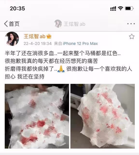 網紅Abbily「變性」後發文感慨後遺症，半年了還在流血