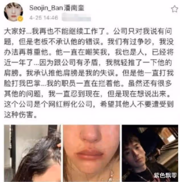 潘南奎:捲走前夫10億財產,整成baby來中國撈金,卻被老闆掌摑?