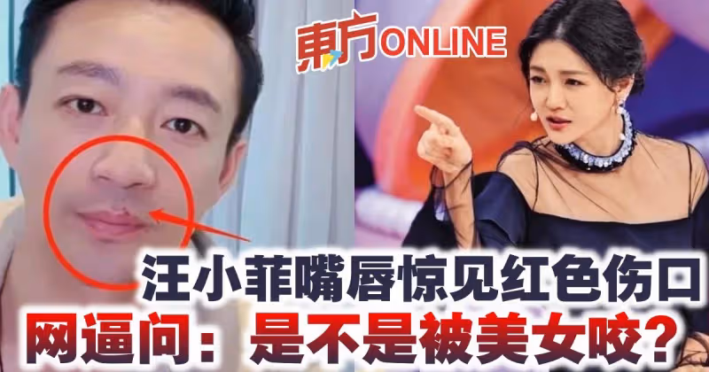 汪小菲嘴唇驚見紅色傷口　網逼問：是不是被美女咬？