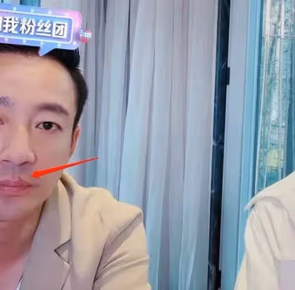 汪小菲嘴唇驚見紅色傷口　網逼問：是不是被美女咬？