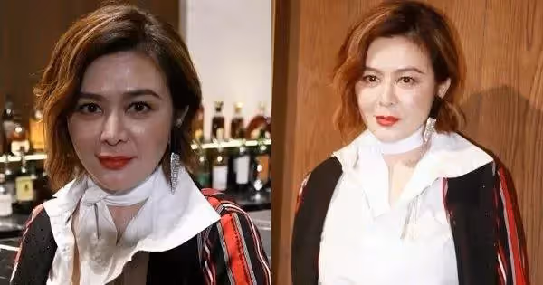 56歲關之琳參加活動被嫌棄,膝蓋小腿慘不忍睹, 網友:心疼女神!