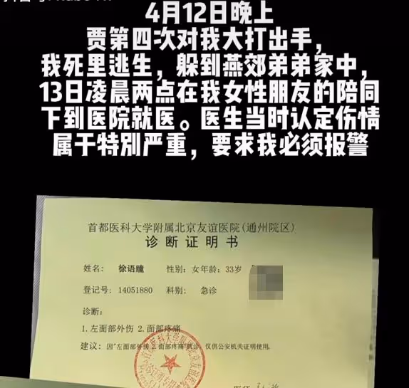 34歲女星慘遭家暴！深夜被拖拽進房間打到眼睛出血，絕望發聲求助