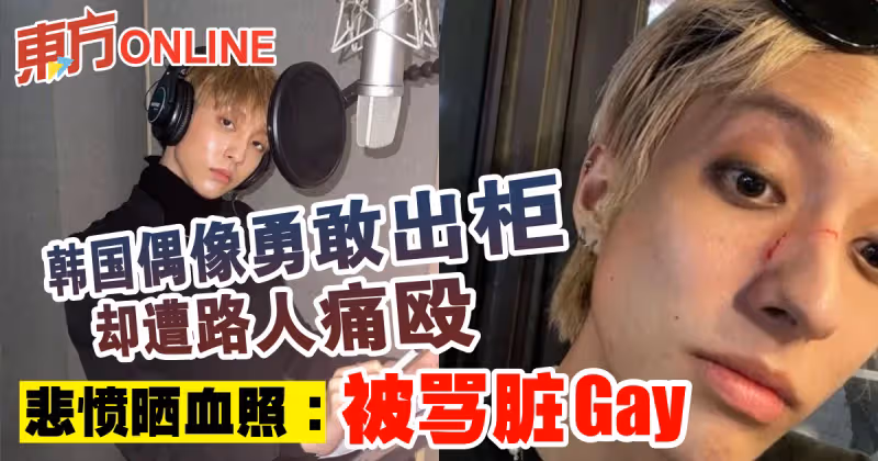 韓國偶像勇敢出櫃卻遭路人痛毆　悲憤曬血照：被罵髒Gay