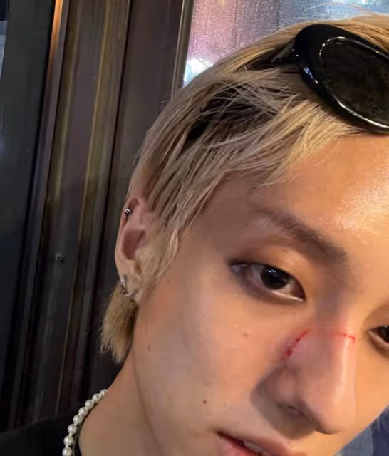 韓國首位公開出櫃男歌手遭路人暴打辱罵:骯髒的GAY!