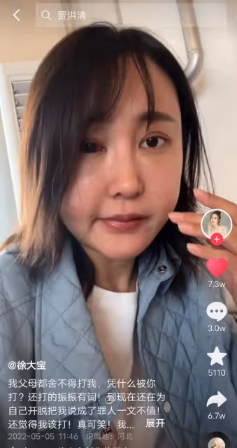 34歲女演員被家暴，拖進房間打到眼腫充血，絕望發聲只為離婚