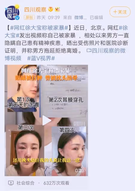 34歲女演員被家暴,拖進房間打到眼腫充血,絕望發聲只為離婚