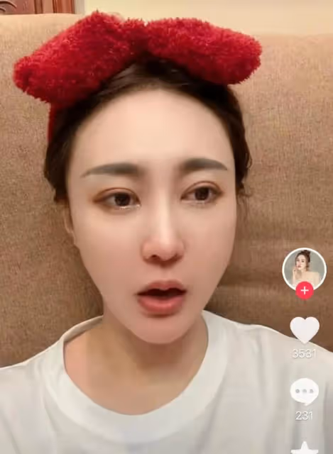 34歲女演員被家暴,拖進房間打到眼腫充血,絕望發聲只為離婚
