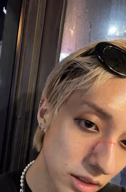 韓出櫃歌手遭恐同黑粉襲擊後發聲：希望這種事不再發生在他人身上