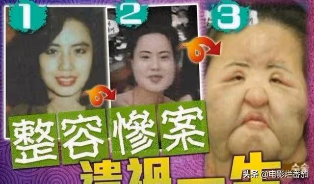 整容成癮韓慧景：把臉整得面目全非，給自己注射機油，後悔莫及