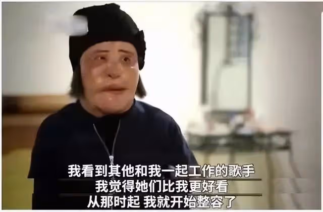 整容成癮韓慧景：把臉整得面目全非，給自己注射機油，後悔莫及