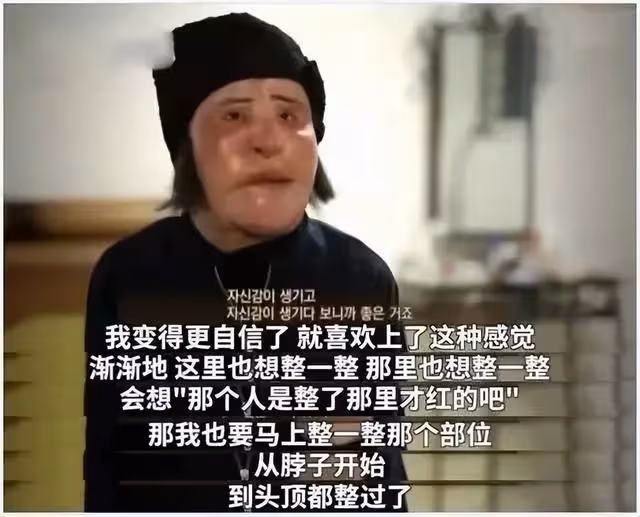 整容成癮韓慧景：把臉整得面目全非，給自己注射機油，後悔莫及
