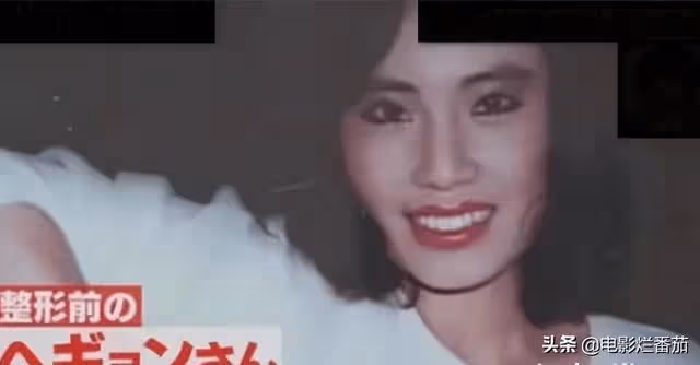 整容成癮韓慧景：把臉整得面目全非，給自己注射機油，後悔莫及
