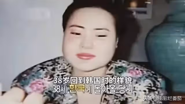 整容成癮韓慧景：把臉整得面目全非，給自己注射機油，後悔莫及